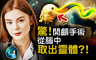 【未解之谜】古代开颅手术