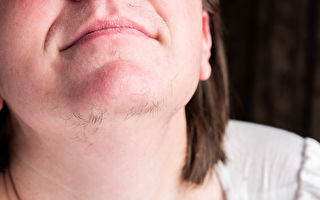 为什么女性的下巴会长毛？应该如何处理？