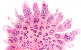 有过性行为者8成概率感染HPV？ 2招速效抗病毒