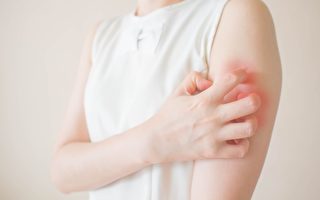 中医开具“换肤方3.0” 有效治疗长新冠皮肤搔痒