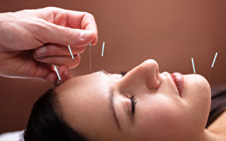 西方人也在积极尝试 你所不知道的7个针灸妙用
