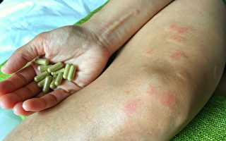 已逝明星患的是终生疾病？关于红斑狼疮一篇看懂