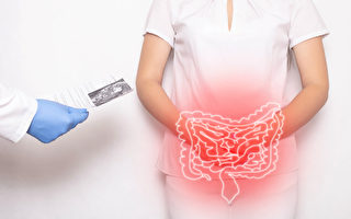 预防第2大夺命癌症 早做一件事生存率超9成