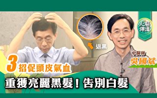 白发原因在肾 黑芝麻加1物 让黑发重生