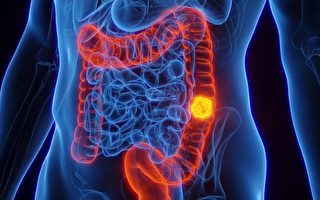 研究：小心这种口腔细菌与肠癌有关