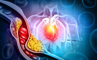 胆固醇高就一定要吃药？注意他汀类药物有这种副作用