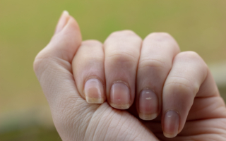 头发和指甲会长多快？ 为何有人长得较快？