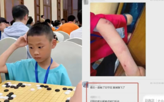 中国9岁围棋天才 遭父家暴跳楼亡