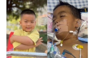 扁桃体微创手术后 广东3岁男童竟“脑死亡”