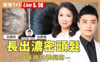 六类常见脱发问题与精油护理方法