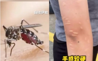 广东双疫情警报 登革热飙升 基孔肯雅热蔓延