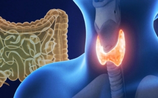 甲状腺功能减退及其改善方法