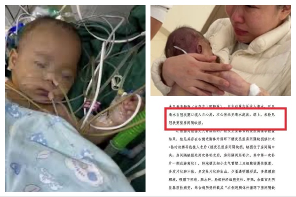宁波女婴小洛熙尸检报告出炉 手术存在重大失误