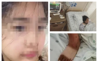 河南女生遭体罚昏迷不醒 父:女教官命脱光爬行